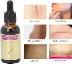 🔥 LIMITED DEAL — Pei Mei Collagen Scar & Acne Mark Removal Repair Essence 30g | Fades Scars & Acne Marks + Boosts Collagen + Repairs & Smooths Skin | KSh 1,200