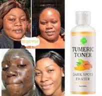 🔥 LIMITED DEAL — MOOYAM Quick Dark Spots Corrector Serum | Fades Dark Spots + Removes Acne Scars + Turmeric Brightening | KSh 1,450