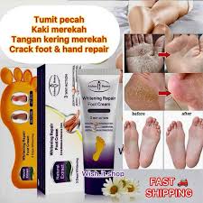 🔥 ORDER 1, WE SEND 2 — Aichun Beauty Whitening Foot Repair Cream | Heals Cracked Heels + Softens Rough Skin + Brightens Feet | KSh 1,500