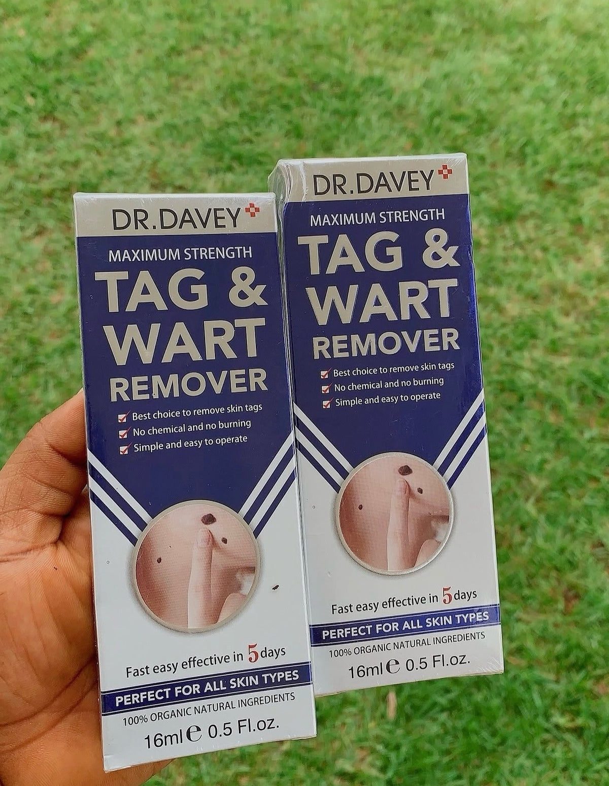 Dr Davey Maximum Strength Tag & Wart Remover | Dries Out & Drops Off Naturally in 10 Days | Discreet Delivery Countrywide