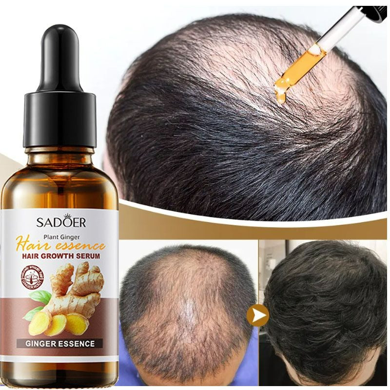 🔥 ORDER 1, WE SEND 2 — Ginger Hair Growth Serum | Stops Hair Loss + Thickens Hair + Deep Moisturising | KSh 3,000