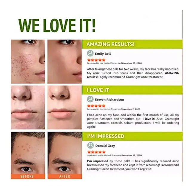 🔥 LIMITED DEAL — Line One Acne Treatment Pills | Clears Breakouts + Balances Oil + Fights Acne From Inside | KSh 2,400