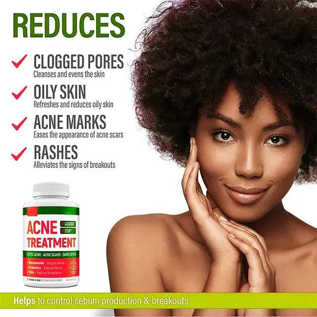 🔥 LIMITED DEAL — Line One Acne Treatment Pills | Clears Breakouts + Balances Oil + Fights Acne From Inside | KSh 2,400