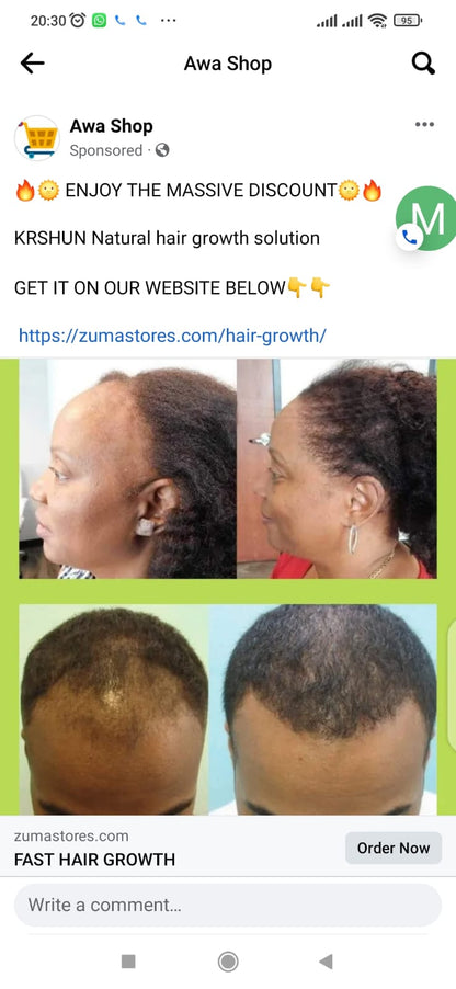 SG Naturals Growth Magic Pro 10 Days Hair Saviour