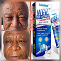 Original Sumifun Wart Remover Ointment 20g — Remove Warts, Skin Tags & Moles Fast | No Surgery Needed!