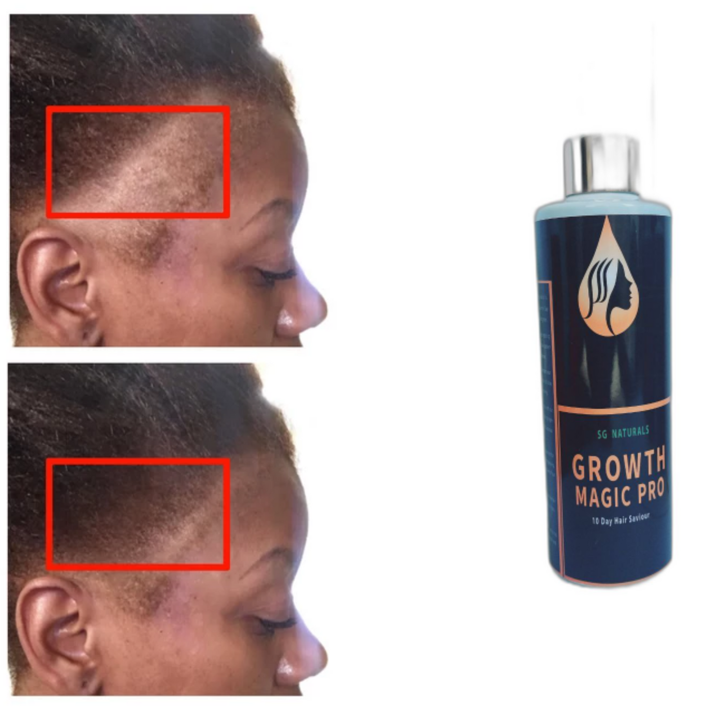 SG Naturals Growth Magic Pro 10 Days Hair Saviour 2