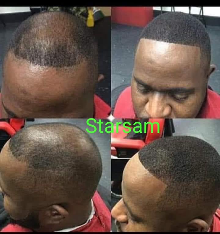 🔥 BUY 1 GET 1 FREE — King of Ginger 7-Day Hair Growth Oil | Stop Breakage + Regrow Hair | KSh 1,800 (B)