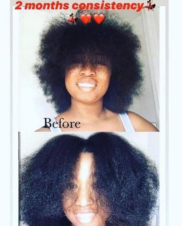 🔥 ORDER 1, WE SEND 2 — KING OF GINGER 7-Day Hair Growth Oil | Stimulates Growth + Stops Breakage + Anti Hair Loss | KSh 1,800
