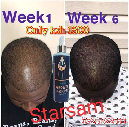 SG Naturals Growth Magic Pro 10 Days Hair Saviour