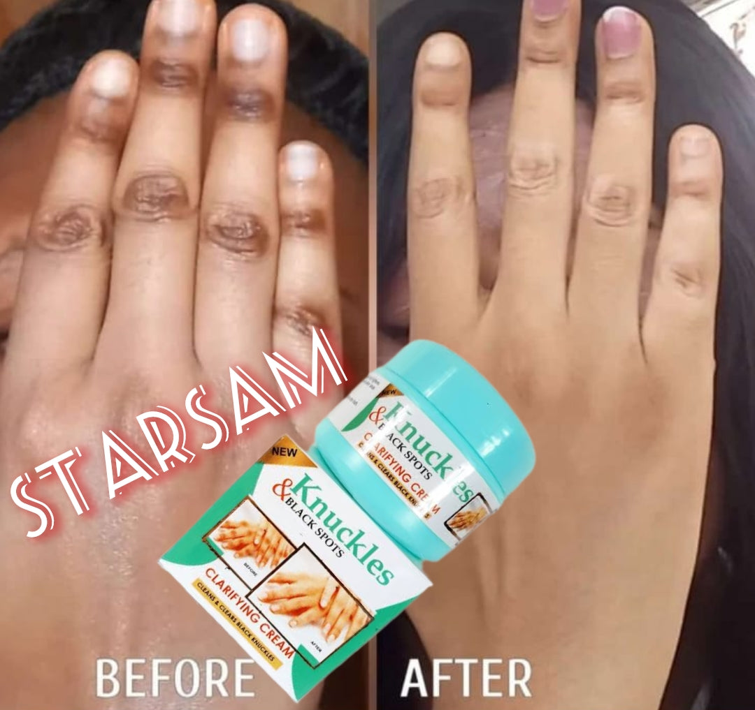 🔥 LIMITED DEAL — Skin Beauty Dark Knuckles & Black Spot Cream | Clears Knuckles + Elbows + Knees + Dark Spots | KSh 1,800