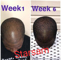 🔥 BUY 1 GET 1 FREE — King of Ginger 7-Day Hair Growth Oil | Stop Breakage + Regrow Hair | KSh 1,800 (A))