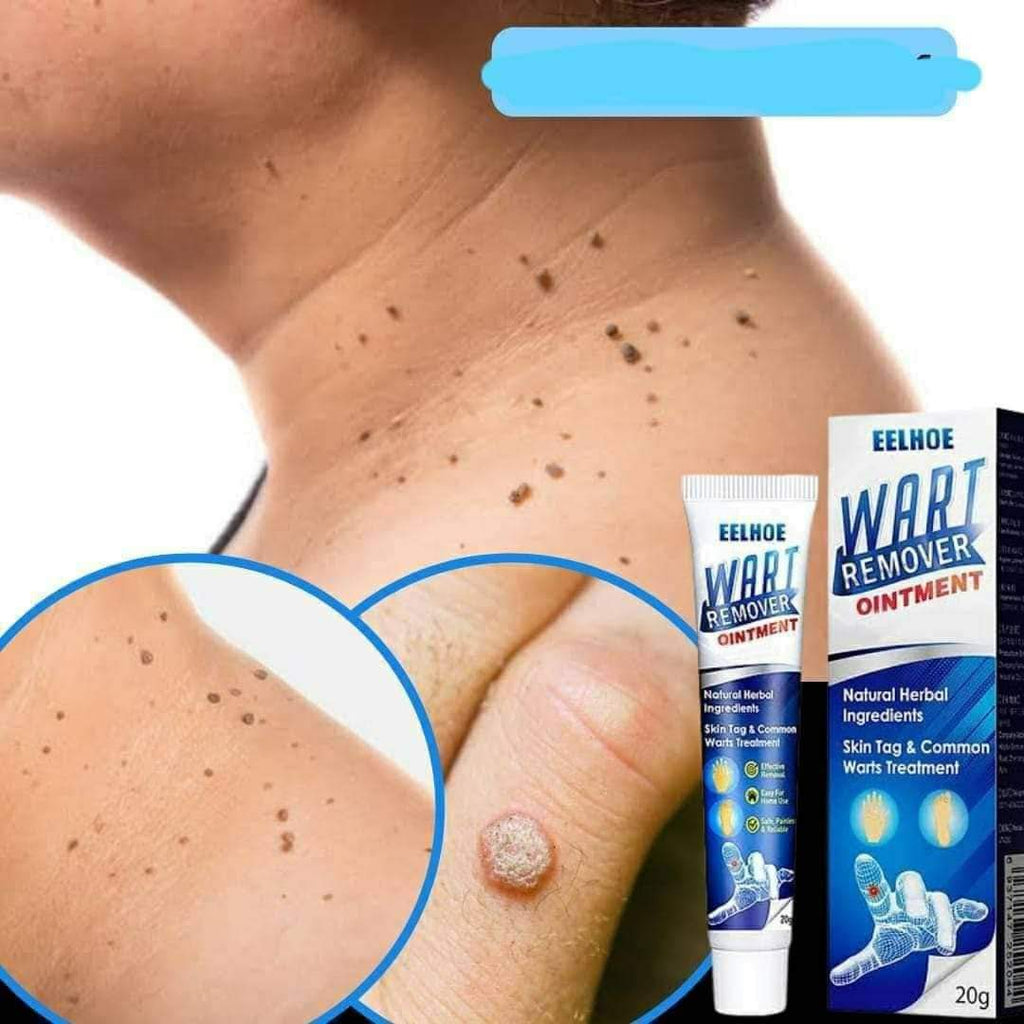 Original Sumifun Wart Remover Ointment 20g — Remove Warts, Skin Tags & Moles Fast | No Surgery Needed!