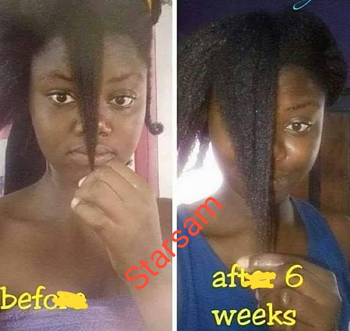 First Class Hair Booster