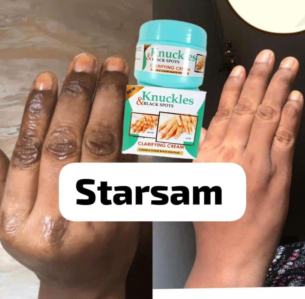 Skin Beauty Black Spot Cream | Erase Dark Knuckles & Elbows ✨ Skin Beauty Black Spot Cream — Fade Dark Knuckles, Elbows & Knees Fast | Clinically Proven Results | Save KSh 25%!Fast | LIMITED STOCK + Surprise Gift! - SAVE KSh 300 TODAY (a)