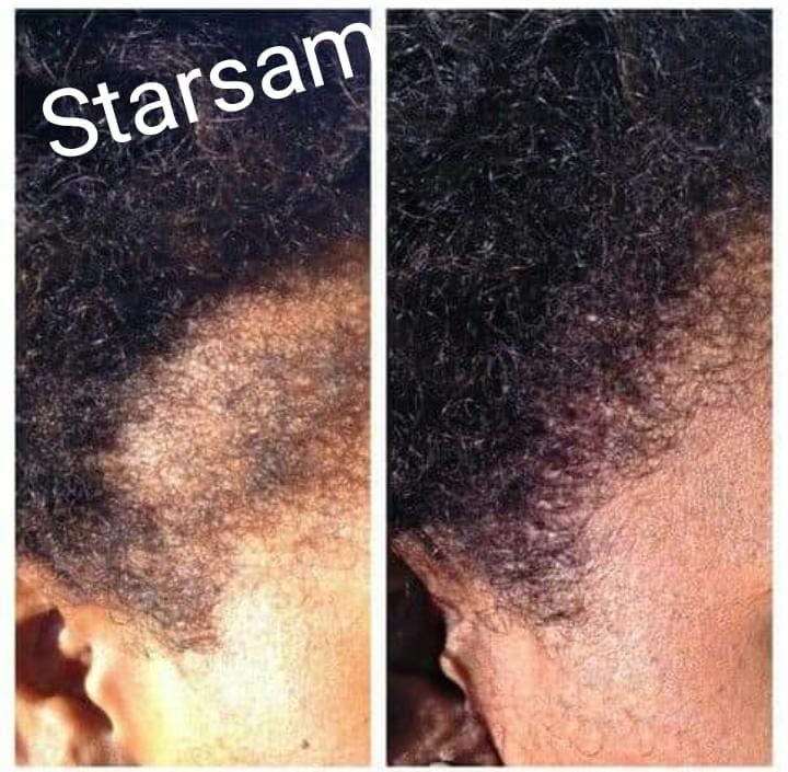 First Class Hair Booster
