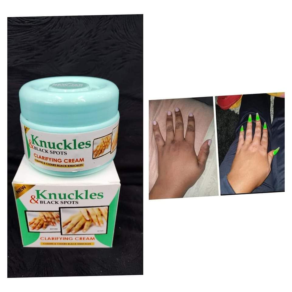 🔥 LIMITED DEAL — Skin Beauty Dark Knuckles & Black Spot Cream | Clears Knuckles + Elbows + Knees + Dark Spots | KSh 1,800