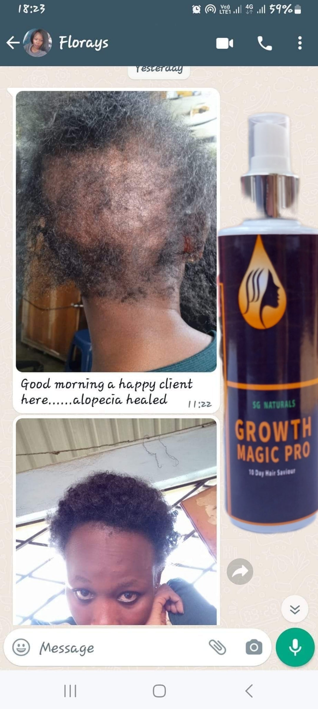 SG Naturals Growth Magic Pro 10 Days Hair Saviour